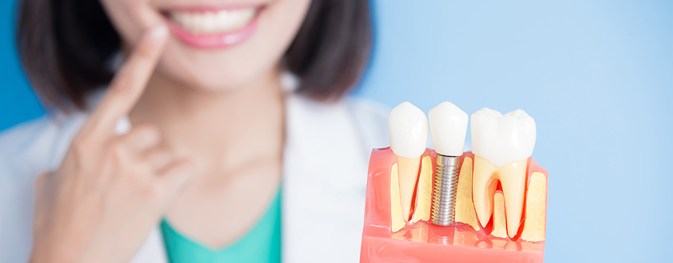 Dental Implant UAE